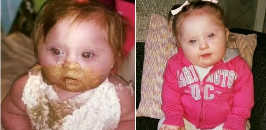 Baby mit Down Syndrom im Internet beleidigt, weil sie Geburtstagskuchen isst